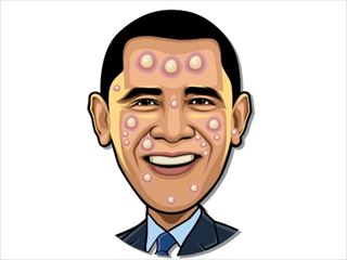 【Celebrity Pimple Pop】Thumbnail Image